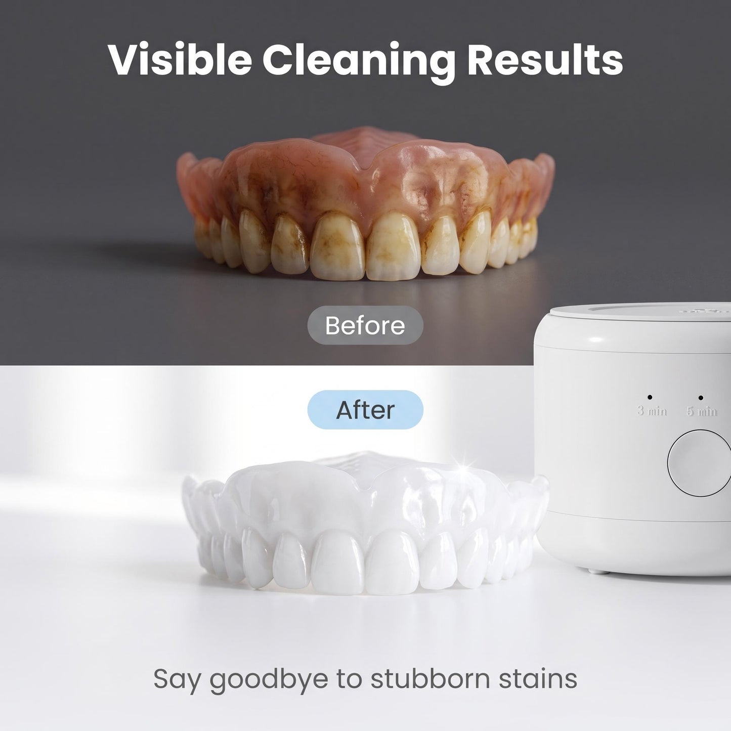 Fogpótlás ultrahangos tisztítókészülék | DENTACLEAN