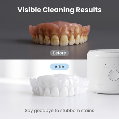Fogpótlás ultrahangos tisztítókészülék | DENTACLEAN
