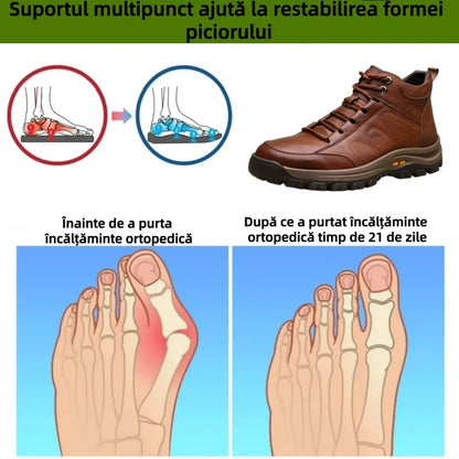 🎁Ultima zi pentru a te bucura de o reducere de 50%, nu o rata! ⏰Fabricați din piele de vițel australiană🐂Suport pentru picioare - ameliorează durerea de picioare✅Impermeabili și antiderapanți, confortabili la mers✅Eleganți și versatili.